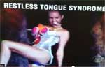 restless tongure syndrome